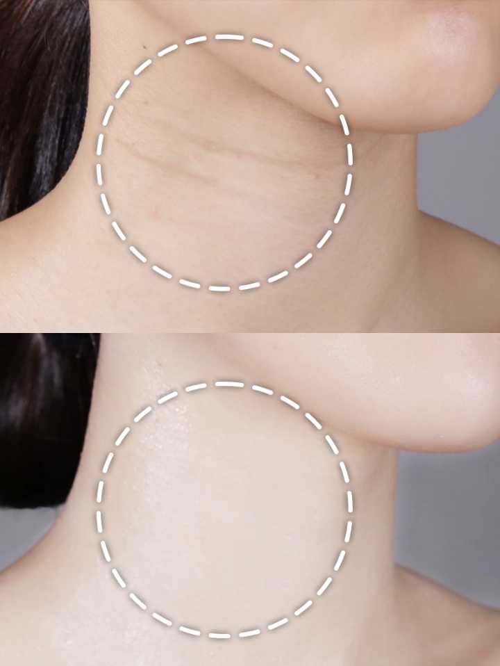 Begin Wrinkle Rolling Cream (Qırış Əleyhinə Diyircəkli Krem)