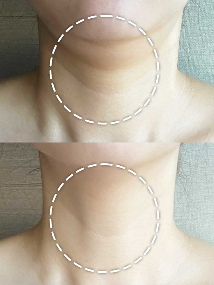 Begin Wrinkle Rolling Cream (Qırış Əleyhinə Diyircəkli Krem)